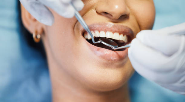 Best Knocked-Out Tooth (Avulsed Tooth) Treatment in Batavia, IL