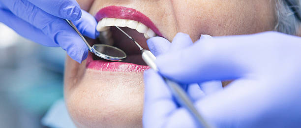 Best Emergency Treatment for Oral Infections in Batavia, IL